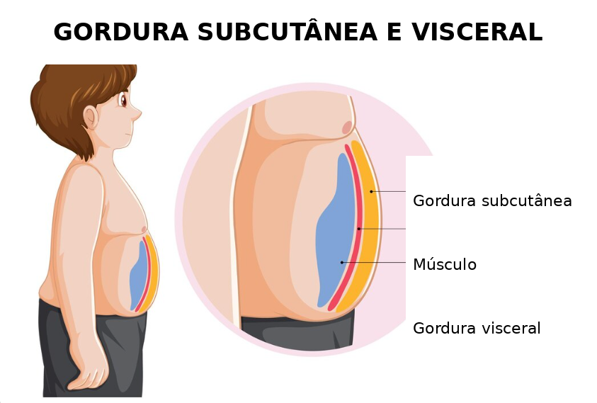 ilustração mostrando gordura corporal cobrindo o músculo e escondendo o shape